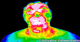 Thermal Imaging